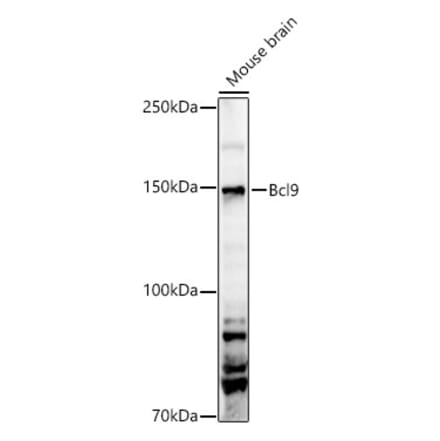 Western Blot - Anti-BCL9 Antibody (A329149) - Antibodies.com