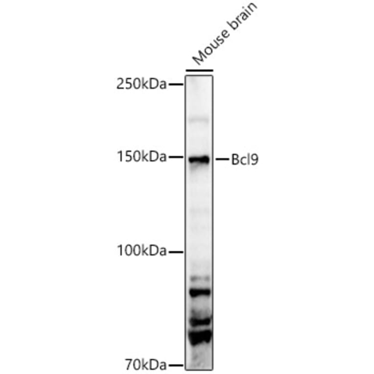 Western Blot - Anti-BCL9 Antibody (A329149) - Antibodies.com