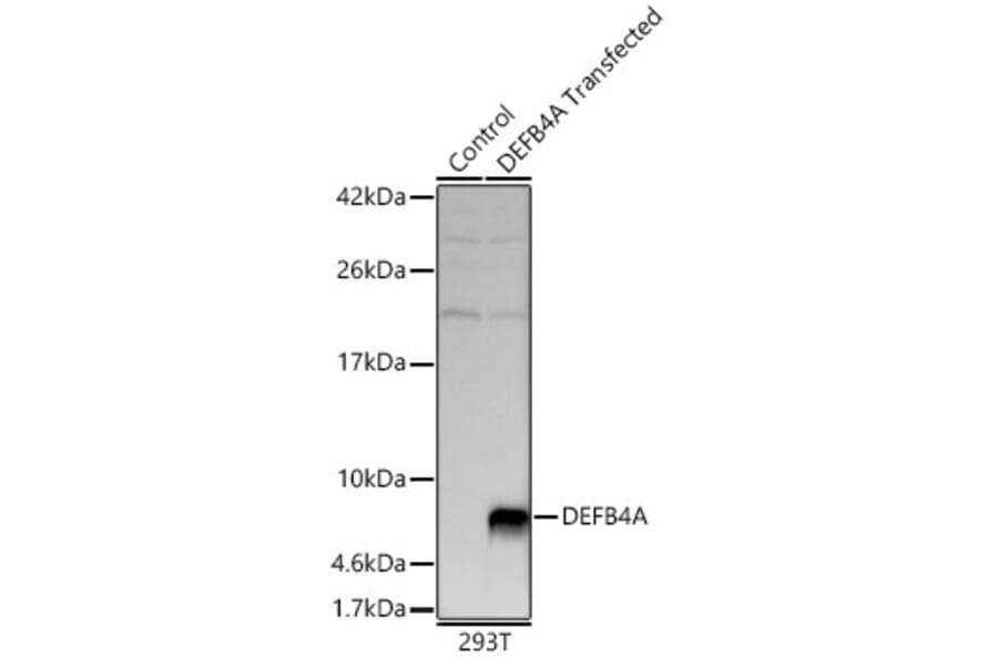 Western Blot - Anti-beta 2 Defensin Antibody (A329151) - Antibodies.com