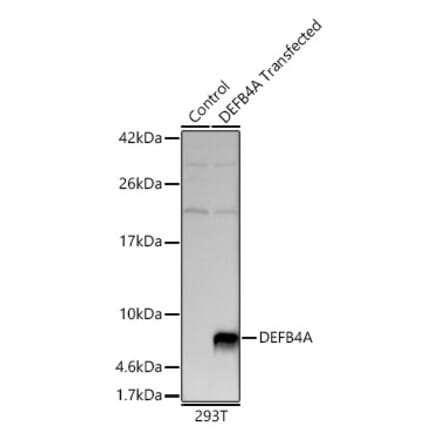 Western Blot - Anti-beta 2 Defensin Antibody (A329151) - Antibodies.com