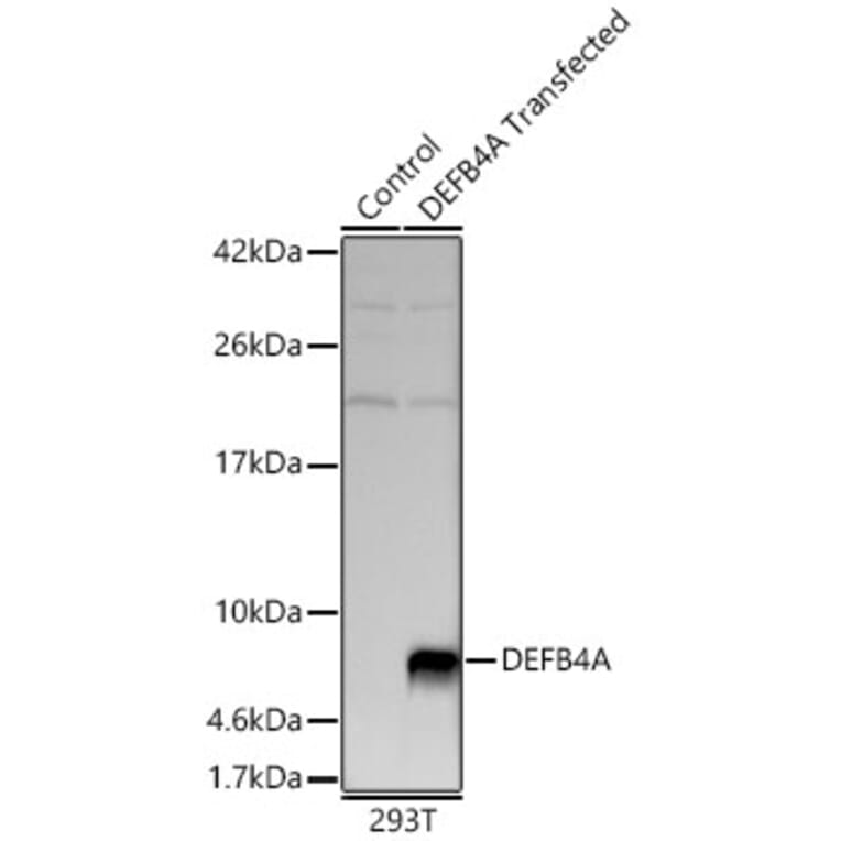 Western Blot - Anti-beta 2 Defensin Antibody (A329151) - Antibodies.com