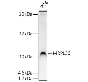 Western Blot - Anti-BRIP1 Antibody (A329156) - Antibodies.com