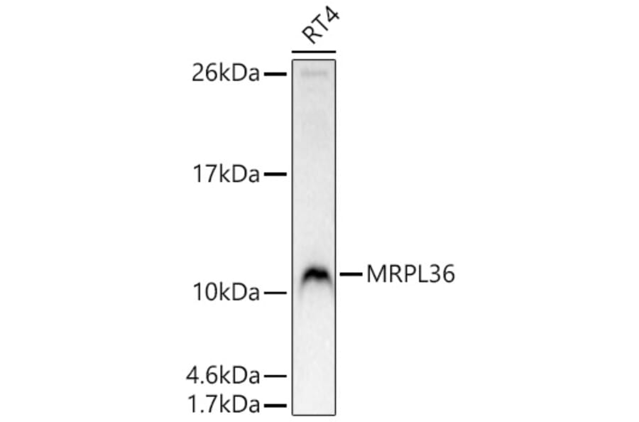 Western Blot - Anti-BRIP1 Antibody (A329156) - Antibodies.com