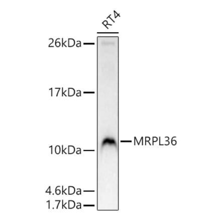 Western Blot - Anti-BRIP1 Antibody (A329156) - Antibodies.com