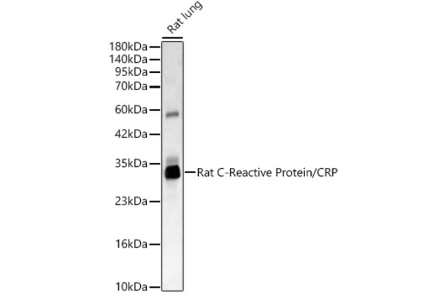 Western Blot - Anti-C Reactive Protein Antibody (A329160) - Antibodies.com