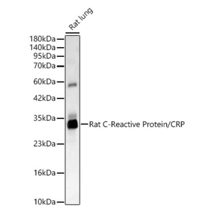 Western Blot - Anti-C Reactive Protein Antibody (A329160) - Antibodies.com