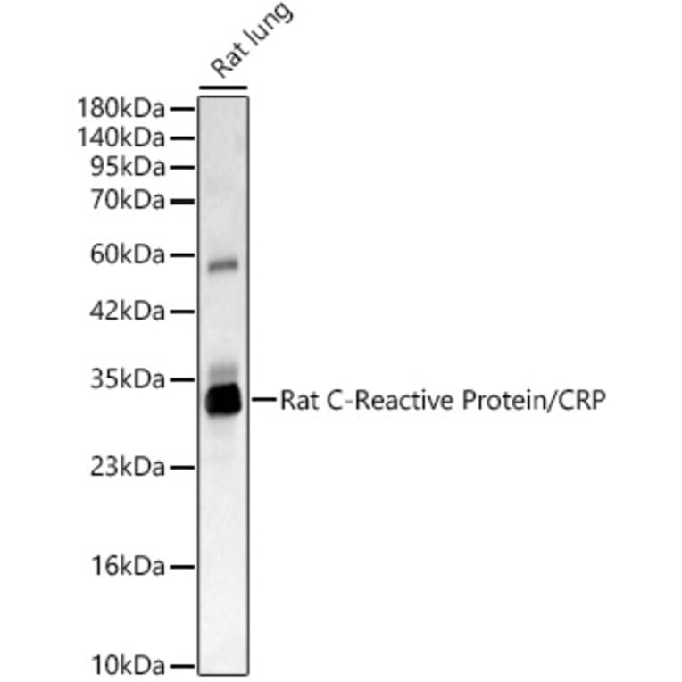 Western Blot - Anti-C Reactive Protein Antibody (A329160) - Antibodies.com