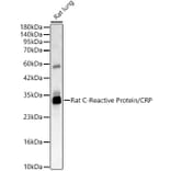 Western Blot - Anti-C Reactive Protein Antibody (A329160) - Antibodies.com