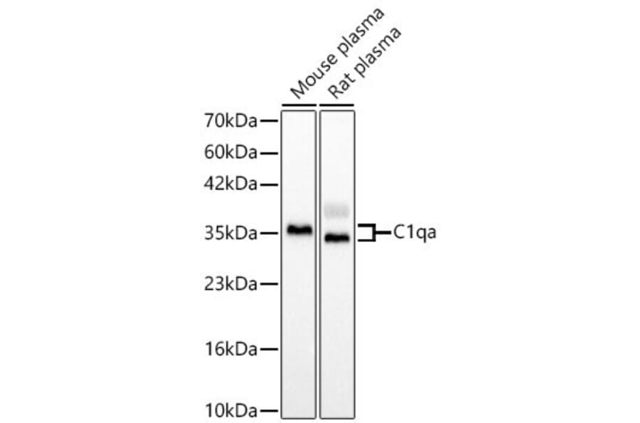 Western Blot - Anti-C1QA Antibody (A329162) - Antibodies.com