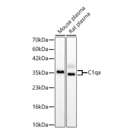 Western Blot - Anti-C1QA Antibody (A329162) - Antibodies.com