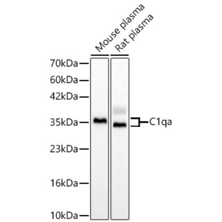 Western Blot - Anti-C1QA Antibody (A329162) - Antibodies.com