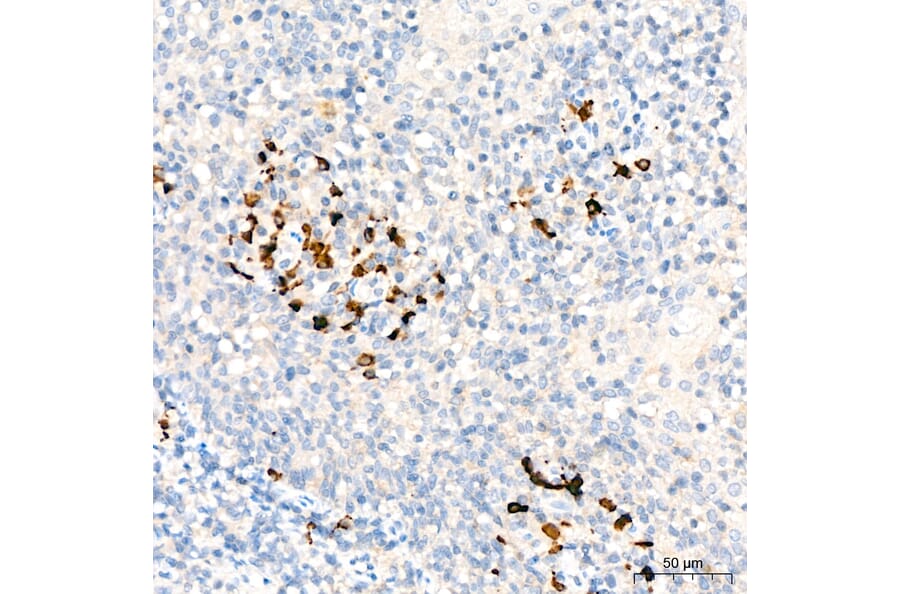 Immunohistochemistry - Anti-C1QA Antibody (A329162) - Antibodies.com