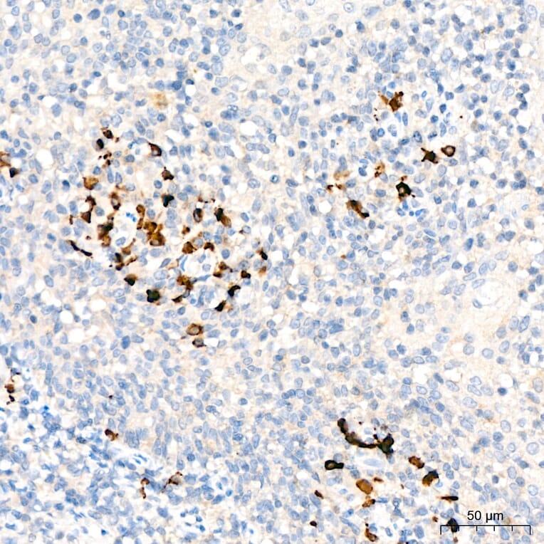 Immunohistochemistry - Anti-C1QA Antibody (A329162) - Antibodies.com