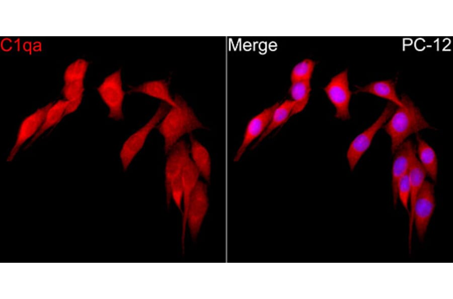 Immunofluorescence - Anti-C1QA Antibody (A329162) - Antibodies.com