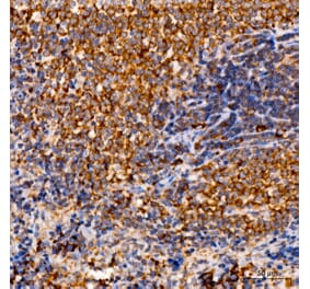 Immunohistochemistry - Anti-C1R Antibody (A329163) - Antibodies.com