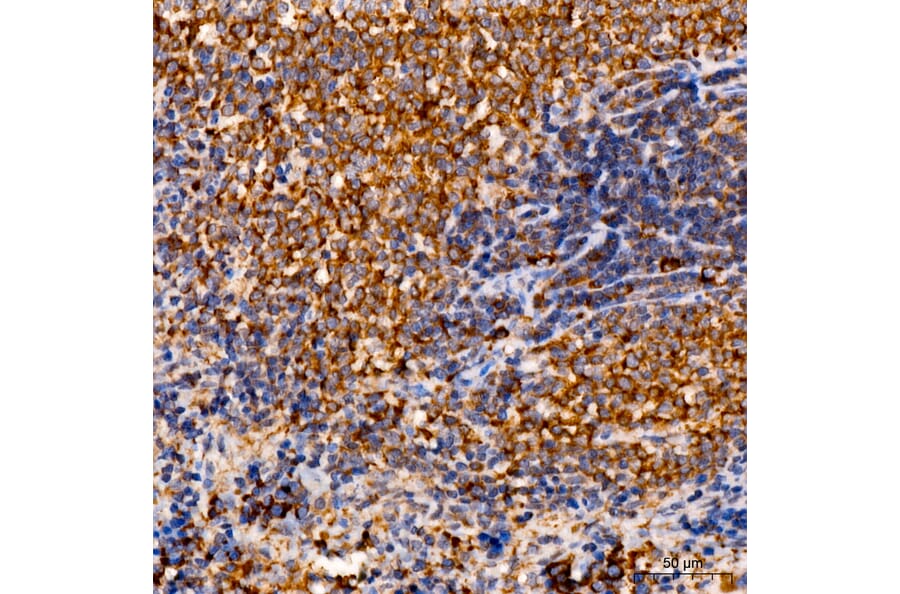 Immunohistochemistry - Anti-C1R Antibody (A329163) - Antibodies.com