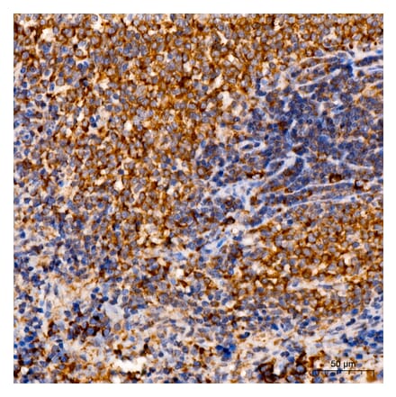 Immunohistochemistry - Anti-C1R Antibody (A329163) - Antibodies.com