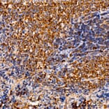 Immunohistochemistry - Anti-C1R Antibody (A329163) - Antibodies.com