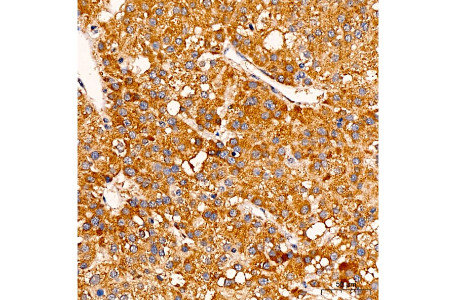 Immunohistochemistry - Anti-C1R Antibody (A329163) - Antibodies.com