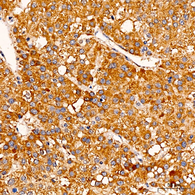 Immunohistochemistry - Anti-C1R Antibody (A329163) - Antibodies.com