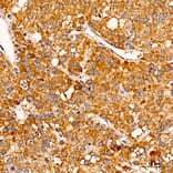 Immunohistochemistry - Anti-C1R Antibody (A329163) - Antibodies.com