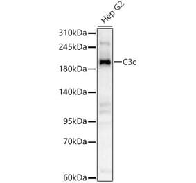 Western Blot - Anti-C3 Antibody (A329164) - Antibodies.com