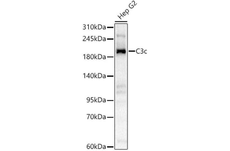 Western Blot - Anti-C3 Antibody (A329164) - Antibodies.com
