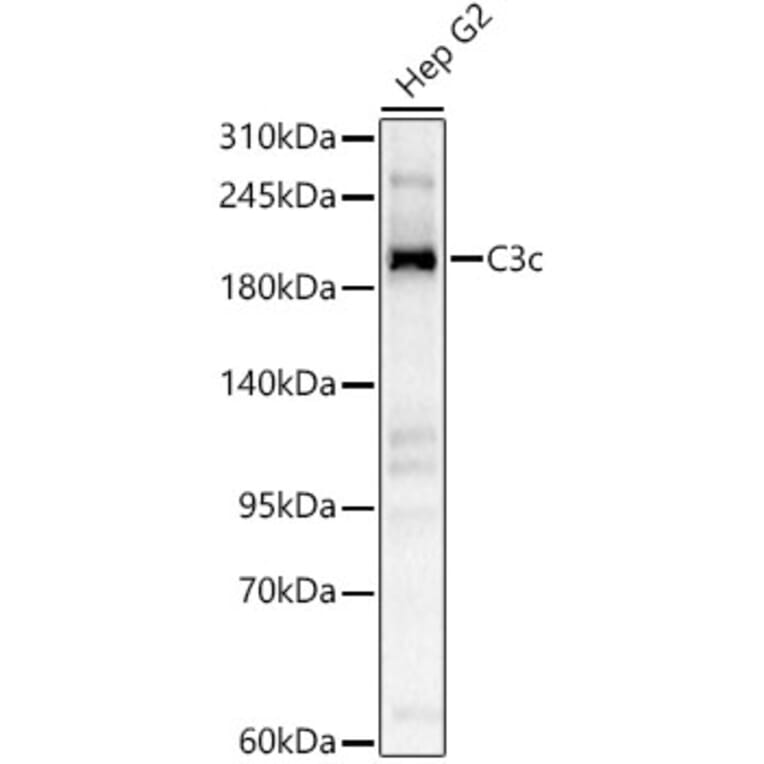 Western Blot - Anti-C3 Antibody (A329164) - Antibodies.com