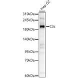 Western Blot - Anti-C3 Antibody (A329164) - Antibodies.com