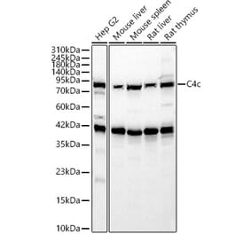 Western Blot - Anti-C4b Antibody (A329166) - Antibodies.com