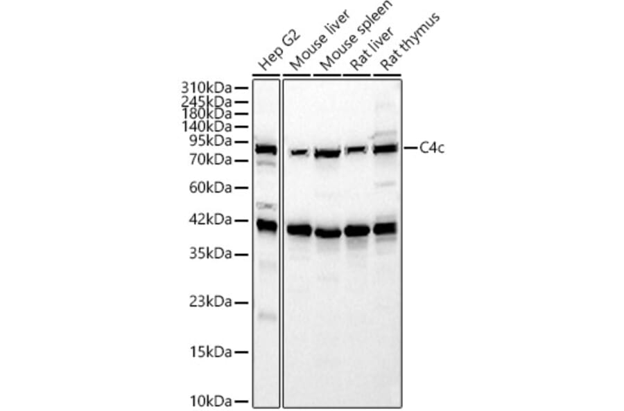 Western Blot - Anti-C4b Antibody (A329166) - Antibodies.com
