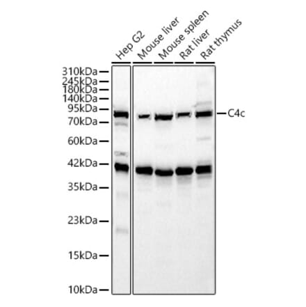 Western Blot - Anti-C4b Antibody (A329166) - Antibodies.com