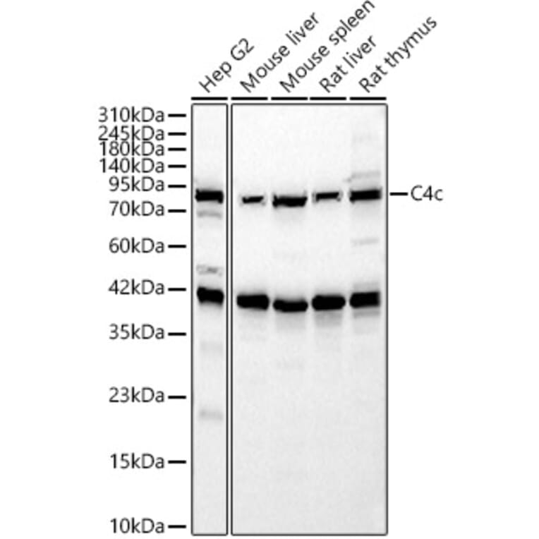 Western Blot - Anti-C4b Antibody (A329166) - Antibodies.com