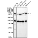 Western Blot - Anti-C4b Antibody (A329166) - Antibodies.com