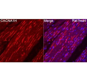 Immunofluorescence - Anti-CACNA1H Antibody (A329167) - Antibodies.com