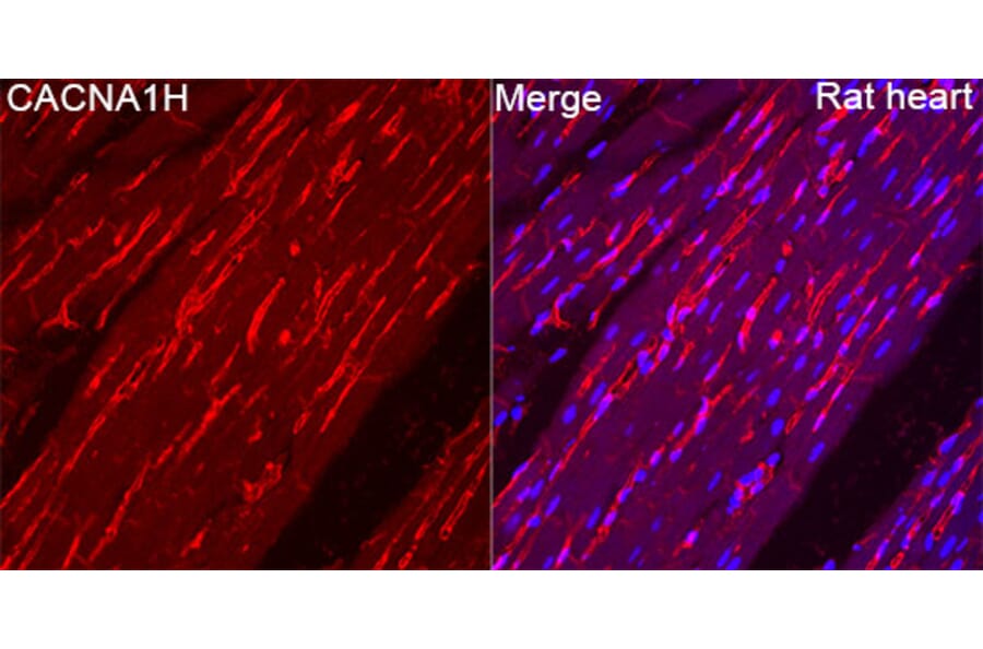 Immunofluorescence - Anti-CACNA1H Antibody (A329167) - Antibodies.com