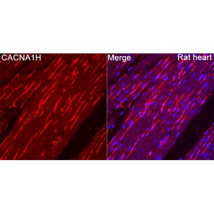 Immunofluorescence - Anti-CACNA1H Antibody (A329167) - Antibodies.com