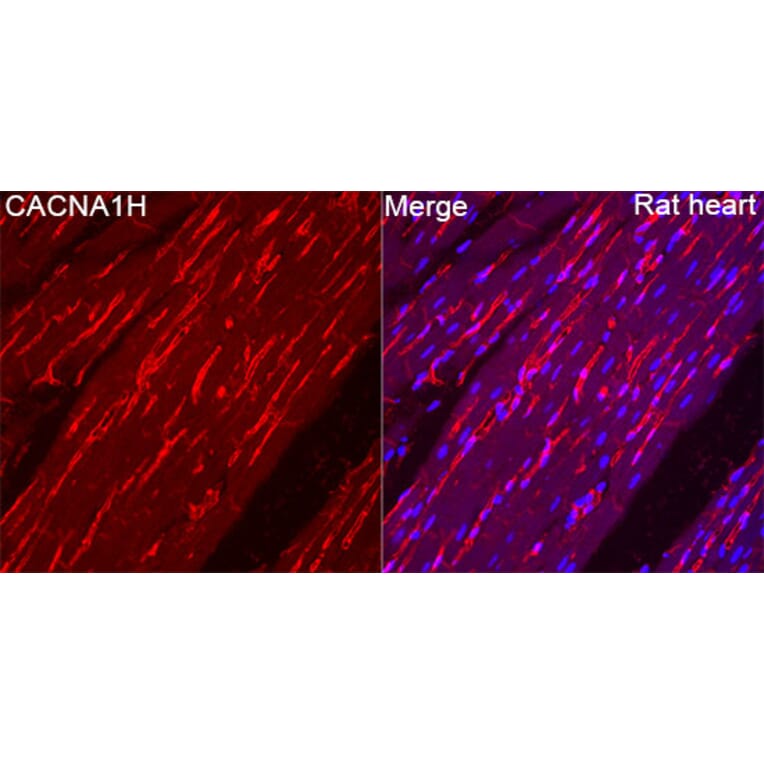 Immunofluorescence - Anti-CACNA1H Antibody (A329167) - Antibodies.com