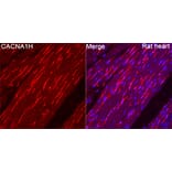 Immunofluorescence - Anti-CACNA1H Antibody (A329167) - Antibodies.com