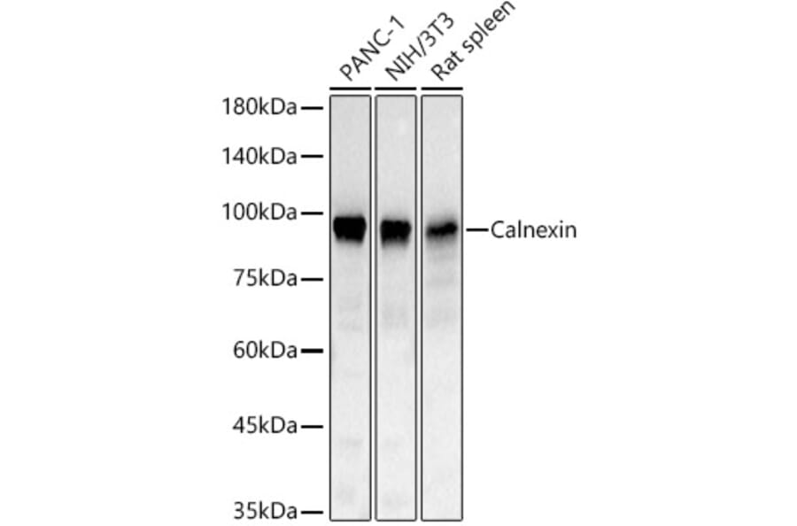 Western Blot - Anti-Calnexin Antibody (A329168) - Antibodies.com
