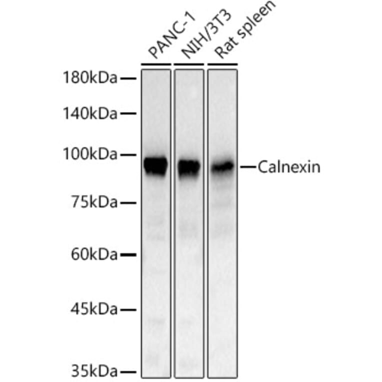 Western Blot - Anti-Calnexin Antibody (A329168) - Antibodies.com