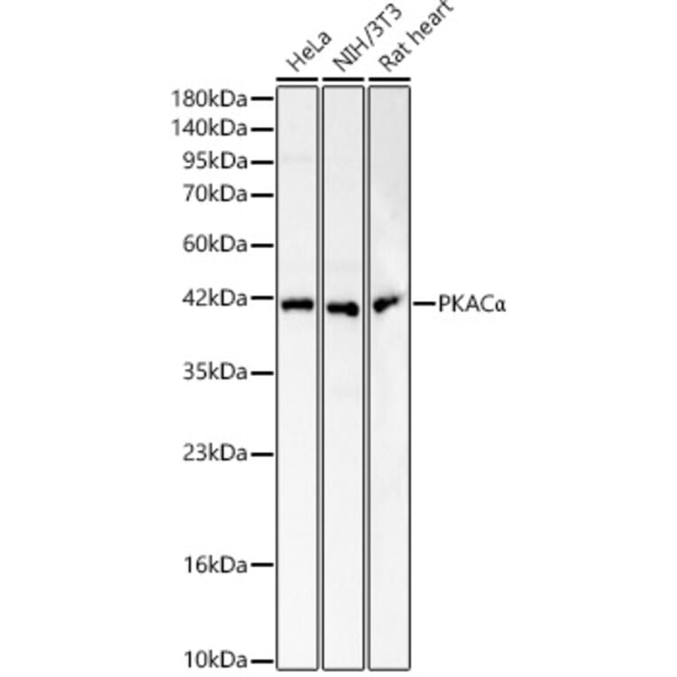 Western Blot - Anti-cAMP Protein Kinase Catalytic subunit Antibody (A329169) - Antibodies.com