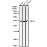 Western Blot - Anti-cAMP Protein Kinase Catalytic subunit Antibody (A329169) - Antibodies.com