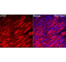 Immunofluorescence - Anti-Cardiac Troponin T Antibody (A329170) - Antibodies.com