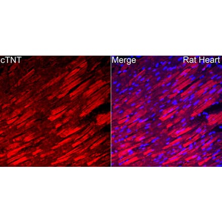 Immunofluorescence - Anti-Cardiac Troponin T Antibody (A329170) - Antibodies.com