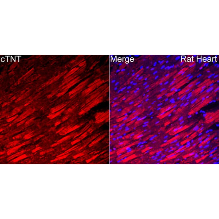 Immunofluorescence - Anti-Cardiac Troponin T Antibody (A329170) - Antibodies.com