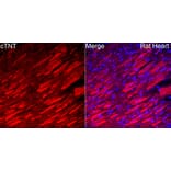 Immunofluorescence - Anti-Cardiac Troponin T Antibody (A329170) - Antibodies.com