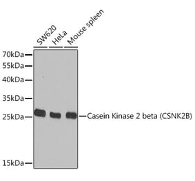 Western Blot - Anti-Casein Kinase 2 beta Antibody (A329171) - Antibodies.com