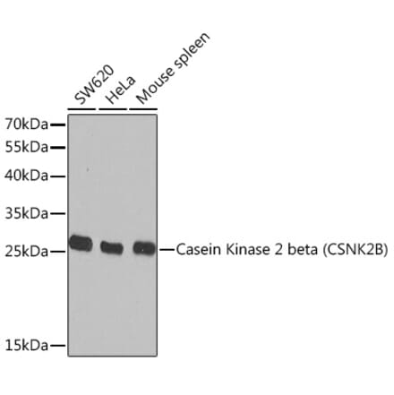 Western Blot - Anti-Casein Kinase 2 beta Antibody (A329171) - Antibodies.com