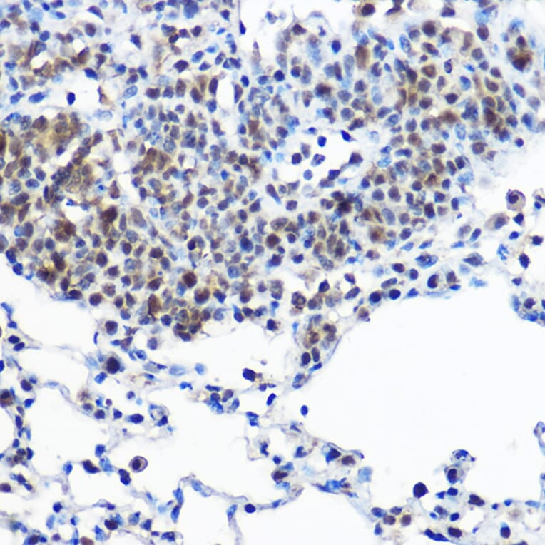 Immunohistochemistry - Anti-Casein Kinase 2 beta Antibody (A329171) - Antibodies.com